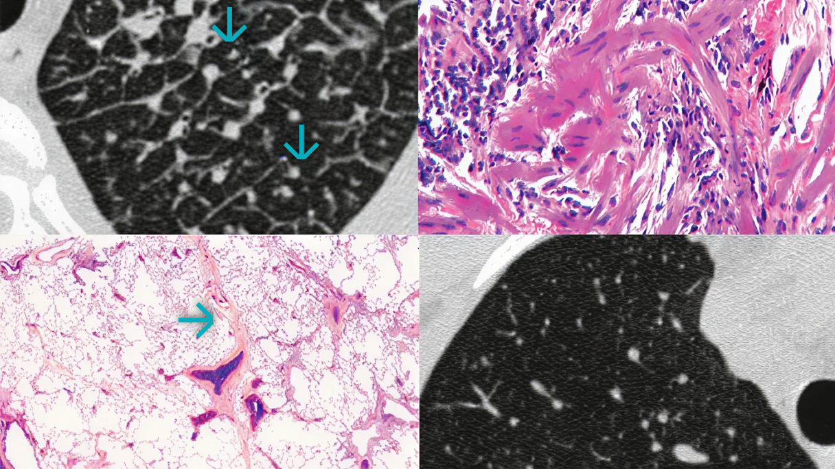 ATLAS_OBRAZOWANIA_ILD