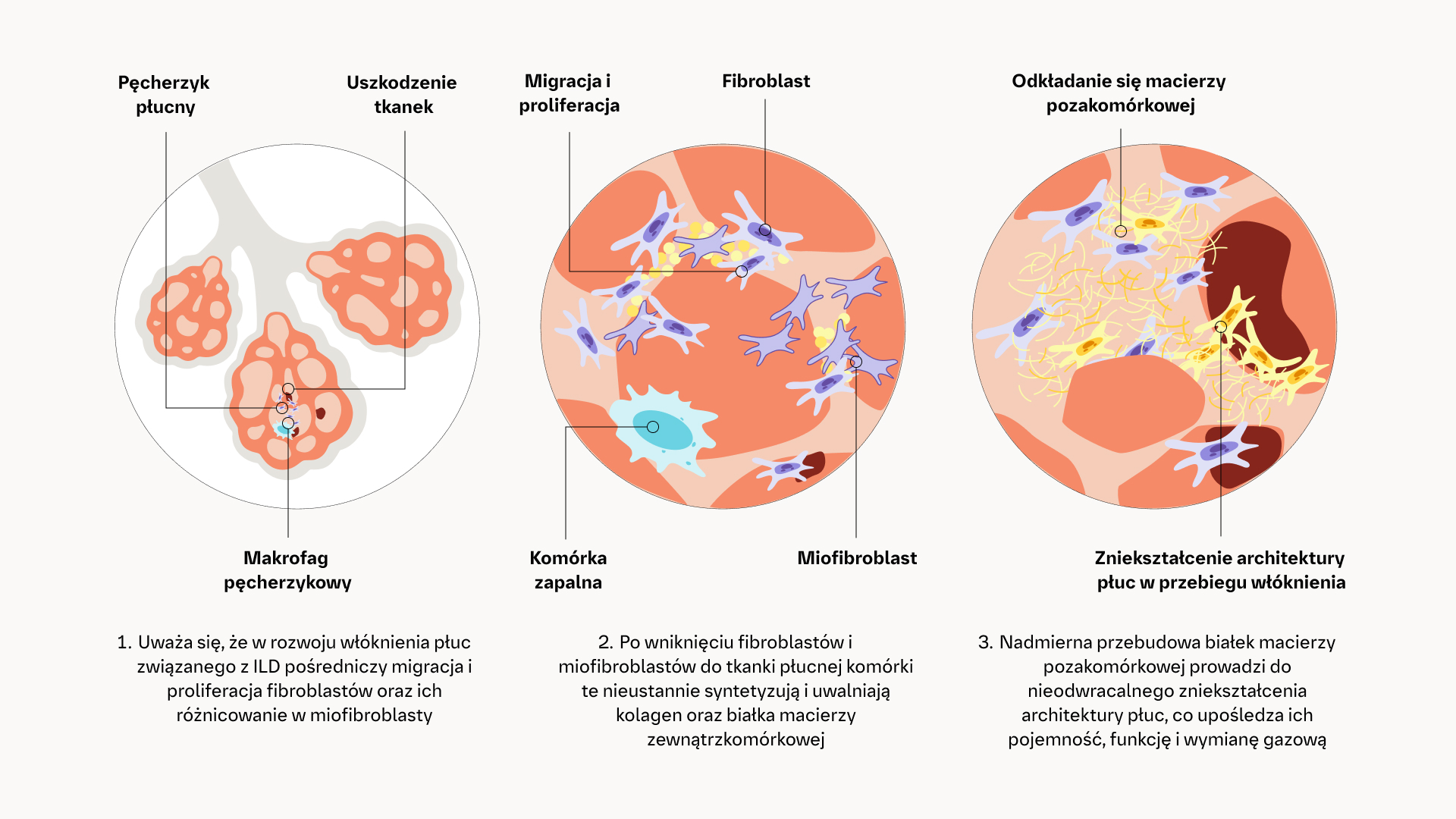 Szlaki patogenetyczne w procesie fibrogenezy