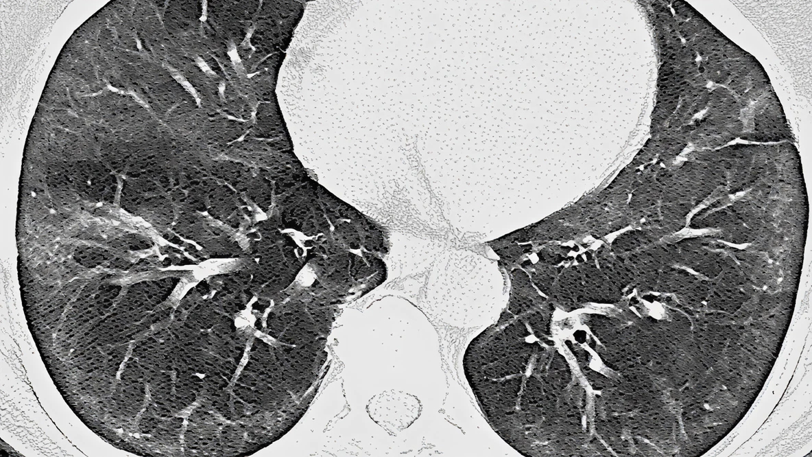 iNSIP – OBRAZ NSIP