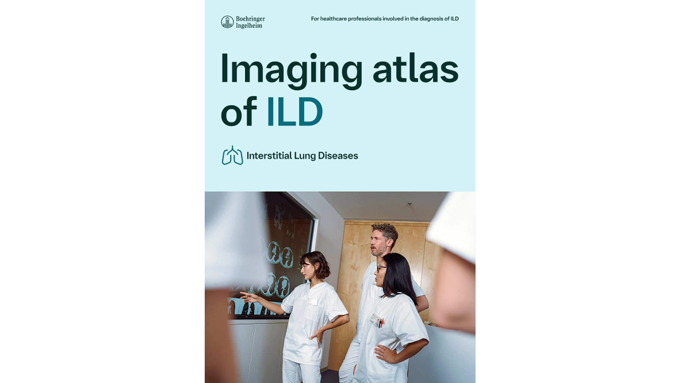 Atlas obrazów – ILD