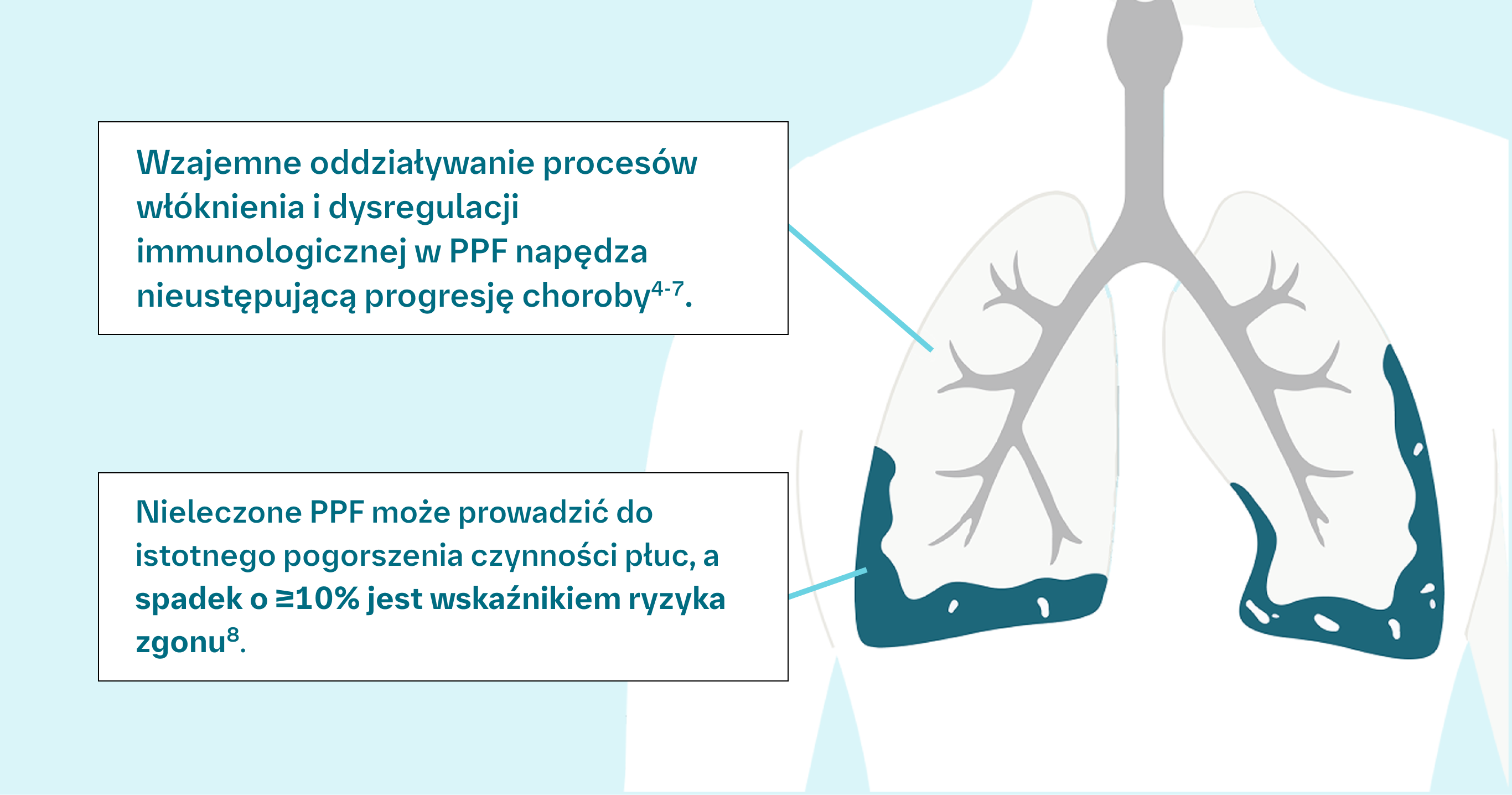 Pacjenci z AI ILD są często bezobjawowi lub prezentują nieswoiste objawy, co może utrudniać rozpoznanie